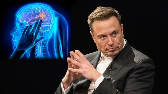 Elon Musk duyurdu, beyin çipi ikinci hastaya da takıldı